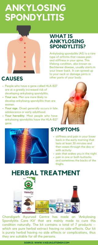 Ankylosing Spondylitis - Causes, Symptoms & Herbal Treatment