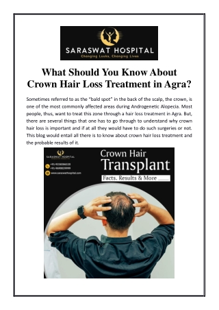 What Should You Know About Crown Hair Loss Treatment in Agra?