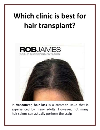 Which clinic is best for hair transplant?