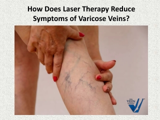 How Does Laser Therapy Reduce Symptoms of Varicose Veins?