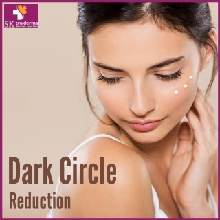 Dark Circle Reduction | Best Dermatologist in Bangalore