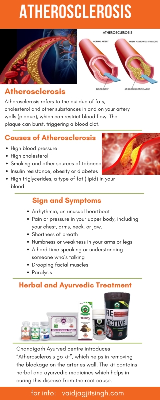 Atherosclerosis  - Causes, Symptoms & Herbal Treatment