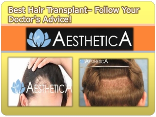 Best Hair Transplant– Follow Your Doctor's Advice!