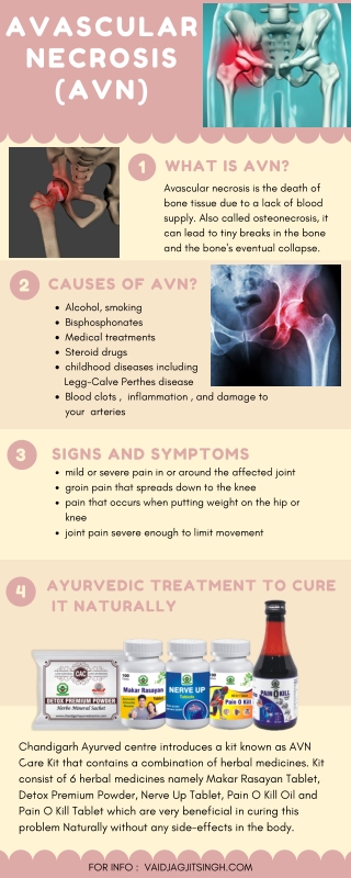 Avascular necrosis - Causes, Symptoms & Herbal Treatment