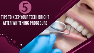 5 Tips to Keep Your Teeth Bright After Whitening Procedure