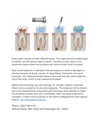 root canal treatment near me