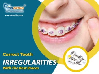 Correct tooth irregularities with the best braces