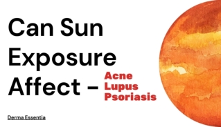 Can sun exposure affect acne, lupus, psoriasis?