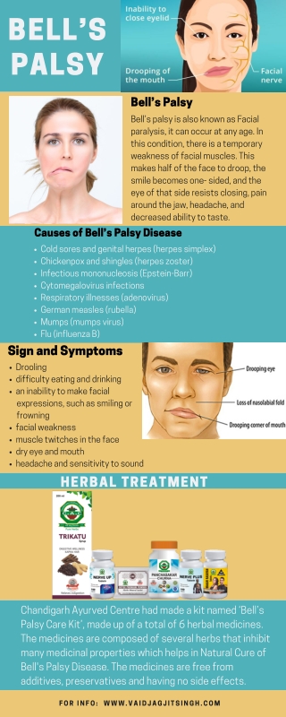 Bell’s palsy - Causes, Symptoms & Herbal Treatment