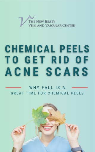 Why Fall Season Is A Great Time For Chemical Peels to Get Rid of Acne Scars