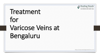 Best treatment for Varicose veins at Bengaluru