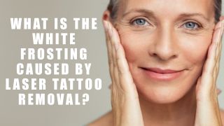 What Is The White Frosting Caused By Laser Tattoo Removal?