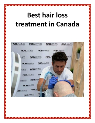 Best hair loss treatment in Canada