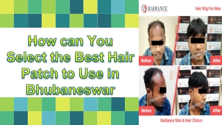 How can You Select the Best Hair Patch to Use in Bhubaneswar