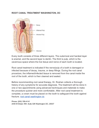 root canal washington dc