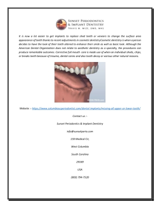 Full Mouth Reconstruction in Columbia, SC