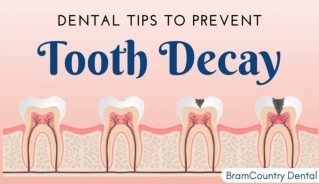 Dental Tips to Prevent Tooth Decay by the Dentist in Brampton