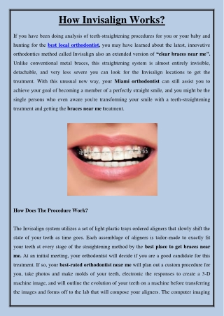 How Invisalign Works?