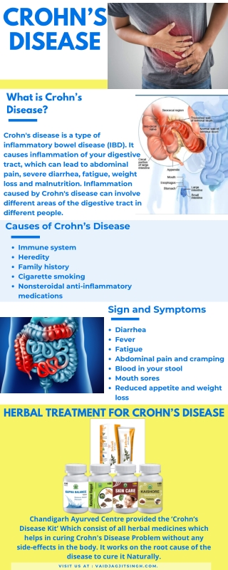 Crohn's disease - Causes, Symptoms & Herbal Treatment