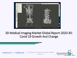 3D Medical Imaging Market 2020: Global Growth, Trends And Forecast