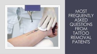 Most Frequently Asked Questions from Tattoo Removal Patients