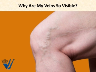 Why Are My Veins So Visible/ | USA Vein Clinics