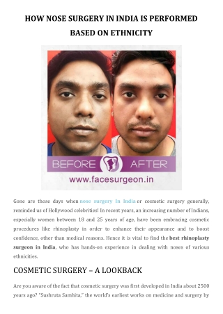 How Nose Surgery In India Is Performed Based On Ethnicity