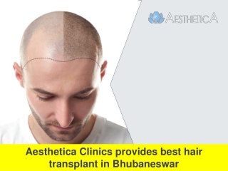 Aesthetica Clinics provides best hair transplant in Bhubaneswar
