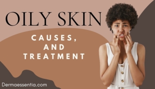 Oily Skin: Causes, and Treatment