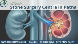 Best Stone Surgery Centre in Patna : Saroj Multispeciality Centre
