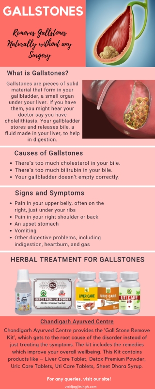 GallStones- Causes, Symptoms & Herbal Treatment