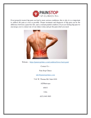 Sciatica Clinic Maryvale Az | Painstopclinics.com