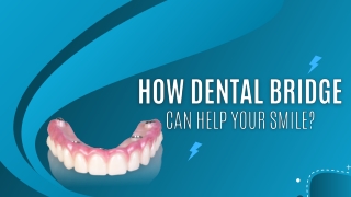 How Dental Bridge Can Help Your Smile