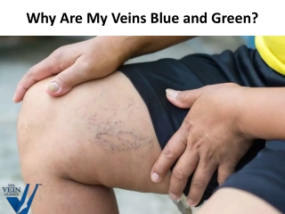 Why Are My Veins Blue and Green?