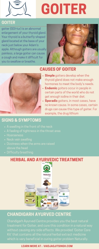 Goiter - Causes, Symptoms & Herbal Treatment