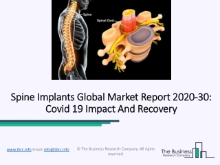 Global Spine Implants Market Competition, SWOT Analysis, Outlook 2023 Forecasts