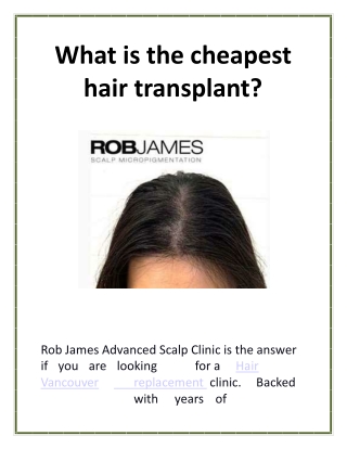 What is the cheapest hair transplant?