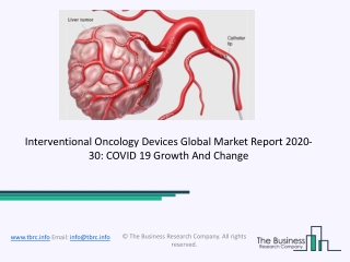 2020 Interventional Oncology Devices Market Share, Restraints, Segments And Regions