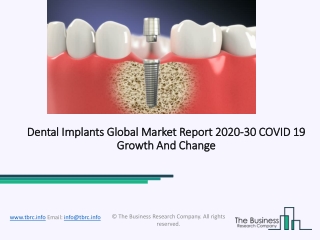 (2020-2030) Dental Implants Market Size, Share, Growth And Trends