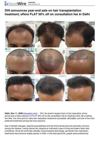 DHI announces year-end sale on hair transplantation treatment; offers FLAT 50% off on consultation fee in Delhi