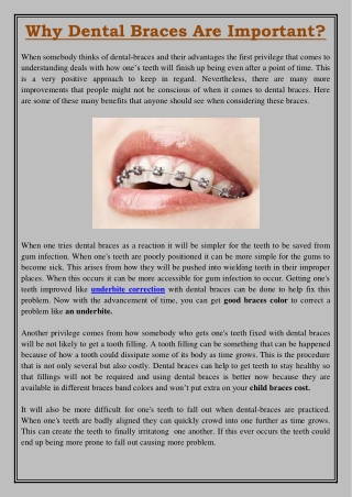Why Dental Braces Are Important?