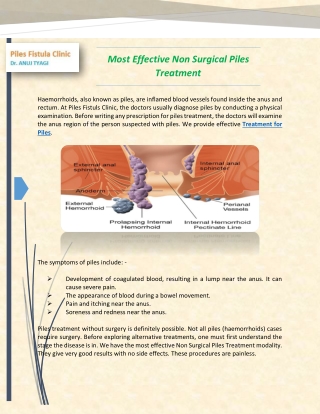 Finest Quality Non Surgical Piles Treatment: Piles Fistuls Clinic