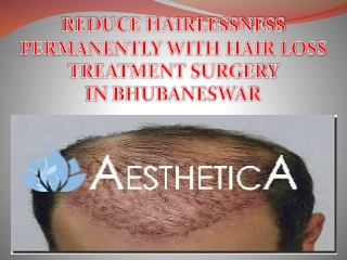 REDUCE HAIRLESSNESS PERMANENTLY WITH HAIR LOSS TREATMENT SURGERY IN BHUBANESWAR