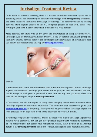 Invisalign Treatment Review