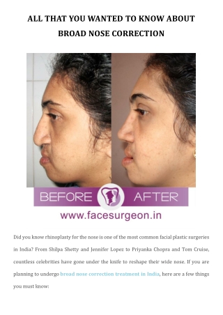 All That You Wanted To Know About Broad Nose Correction