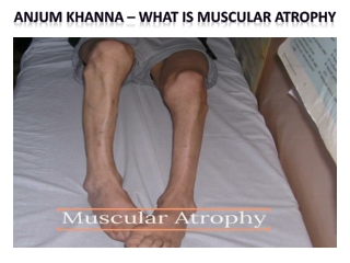 Anjum Khanna – What is Muscular Atrophy