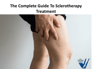 The Ultimate Guide To Sclerotherapy Treatment | USA Vein Clinics