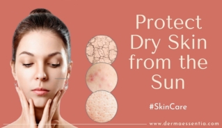 How to Protect Dry Skin from the Sun