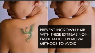 Extreme Non-Laser Tattoo Removal Methods to Avoid