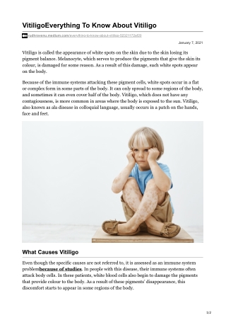 Everything To Know About Vitiligo